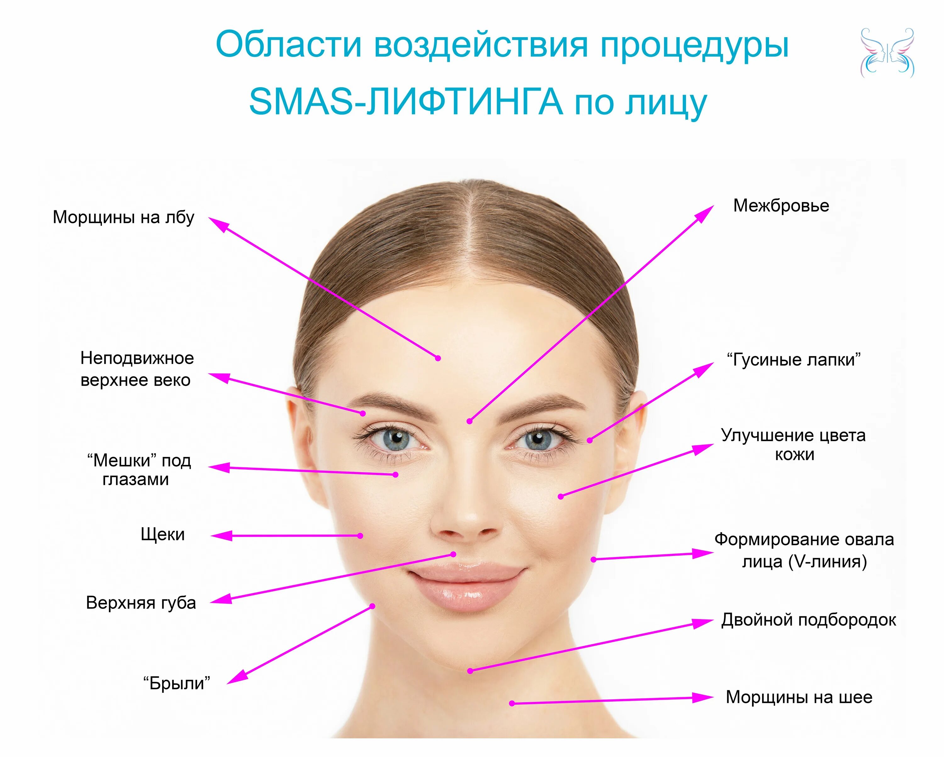 ультра систем смас лифтинг. смас лифтинг альтера зоны. смас лифтинг схема. Hifu smas протокол процедуры. смас лифтинг doublo hifu.