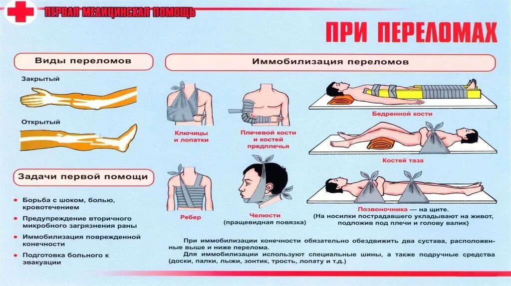 Перелом открытый доврачебной. Алгоритм оказания первой помощи переломы конечностей. Последовательность оказания первой помощи при переломах костей. Алгоритм оказания первой помощи при переломе конечностей. Схема оказания первой помощи при переломах.