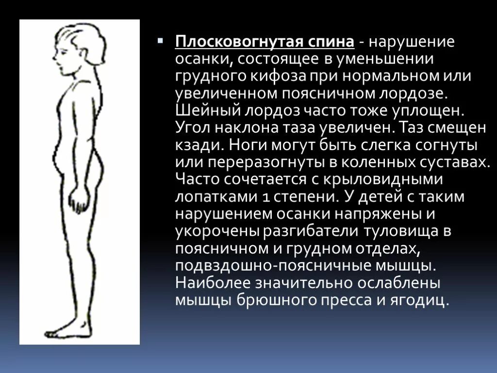 Нарушение осанки доклад. Плосковогнутая спина. плоско вогнутая осанка. нарушения осанки плоско-вогнутая спина. нарушение осанки лордоз.