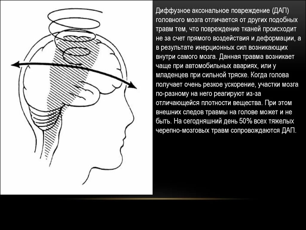 Диффузная травма головного. Диффузное аксональное повреждение. Диффузное аксональное повреждение головного мозга. ДАП диффузное аксональное повреждение. Диффузно аксональные повреждения головного мозга клиника.