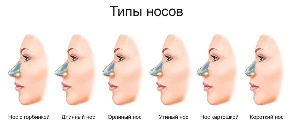 Формы Носов. Типы Носов курносый. Типы Носов с горбинкой. Формы носа. Округлый нос