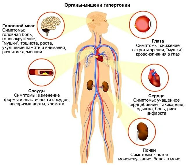 Органы-мишени при артериальной гипертензии. Органы-мишени при гипертоническом кризе. Органы мишени артериальной гипертонии. Органы мишени при гипертонической. Органы мишени при артериальной