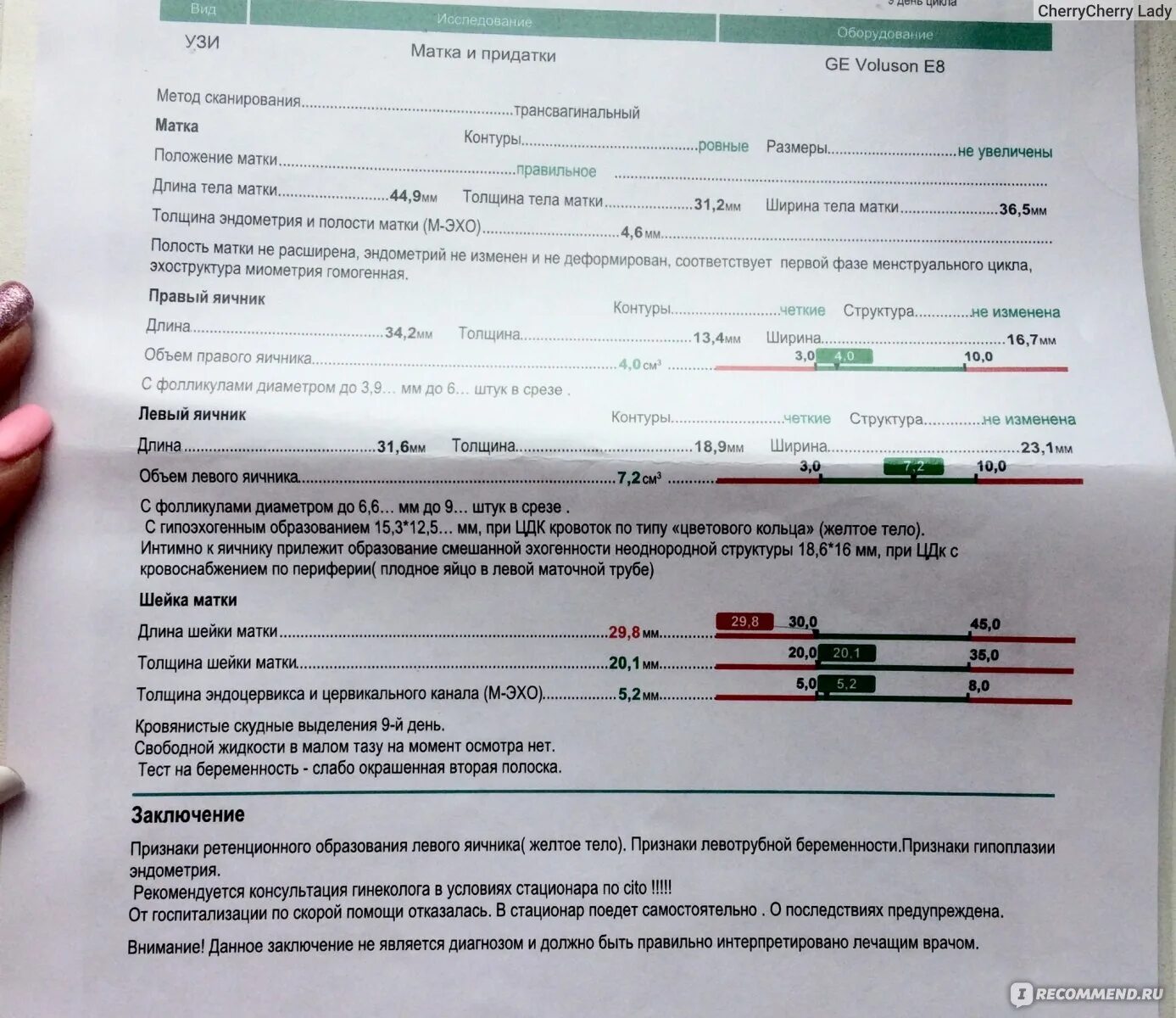 Анализ раньше срока. Внематочная беременность УЗИ заключение. Заключение УЗИ при внематочной беременности. Внематочная беременность тест. Тест при внематочной беременности.