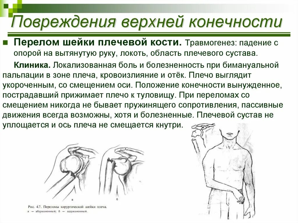 Перелом сильно болит. Перелом хирургической шейки плечевой кости клиника. Перелом хирургической шейки плечевой кости иммобилизация. Симптом осевой нагрузки при переломе плеча. Типичные места переломов костей плеча.