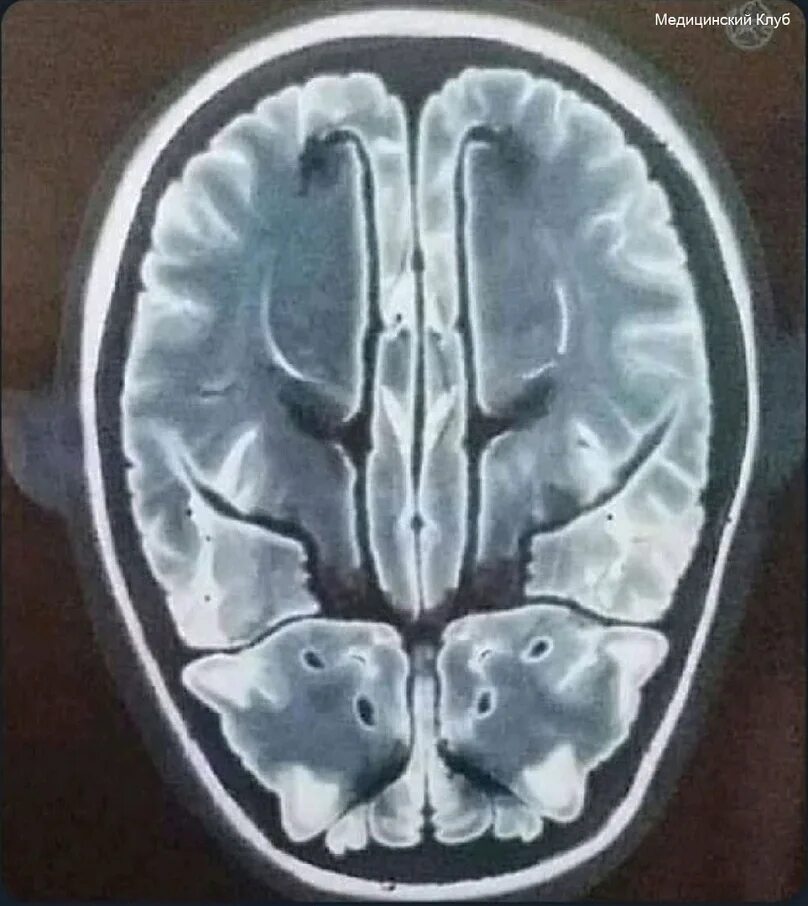 Brain 2024. Коте головного мозга аппарат. Кот головного мозга прикол.