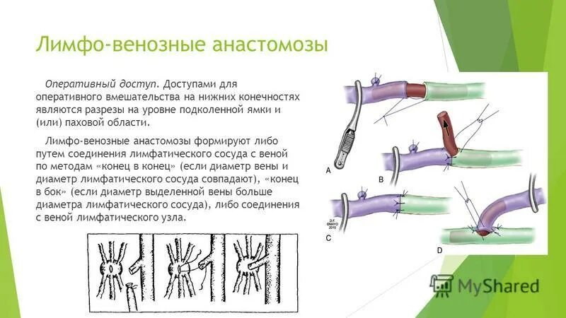 Что такое анастомоз. Анастомоз лимфатических сосудов. лимфовенозные анастомозы. понятие о функциональных лимфо-венозных анастомозах..