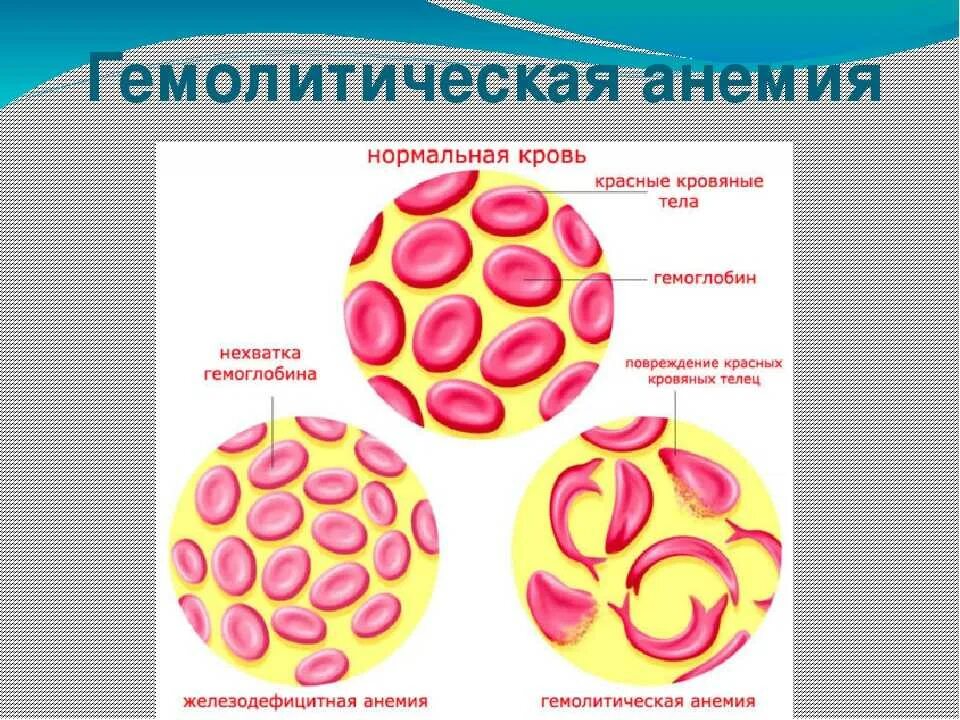 Анемия гемолитического типа. Гемолитическая анемия у животных. Гемолитическая анемия у коровы. Аутоиммунная гемолитическая анемия у животных.