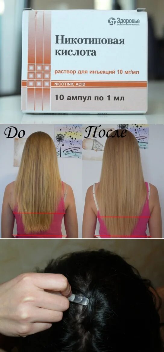 Никотиновая кислота для воло. Никотиновая кислота для рос а волос. Никотиновая кислота для волос в ампулах. Никотиновая кислота для волос втирать. Никотиновая кислота для волос втирать.