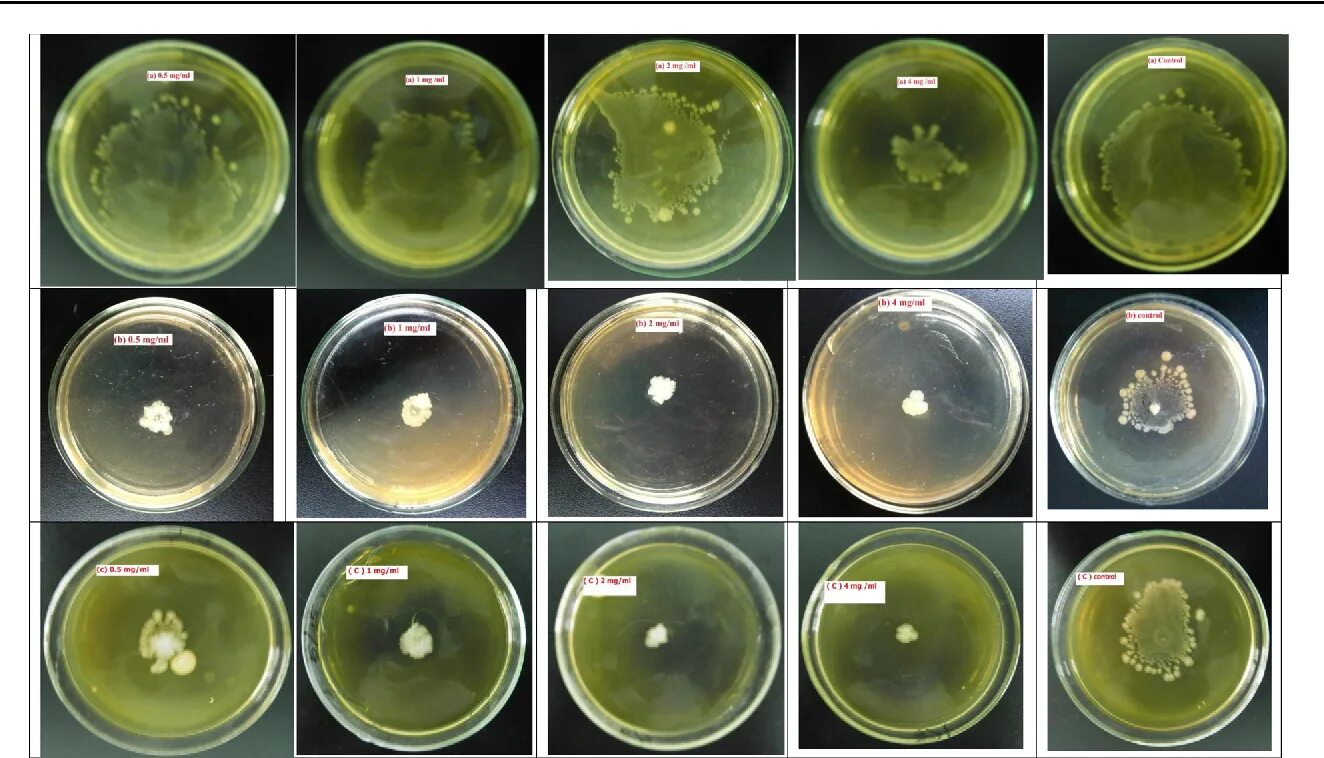 Синегнойная палочка в чашке Петри. Pseudomonas aeruginosa питательная среда. Pseudomonas aeruginosa микробиология. Pseudomonas aeruginosa на чашке Петри.