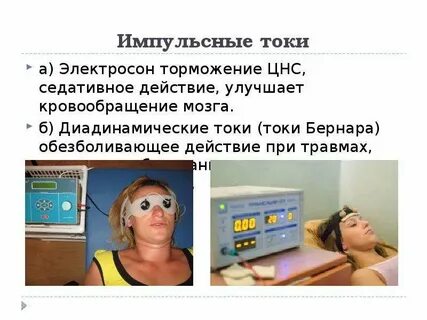 Электросон показания