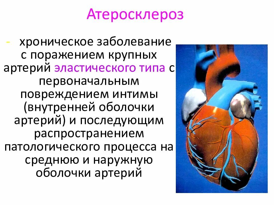 Что такое атеросклероз чем опасен. Атеросклероз презентация. факторы риска атеросклероза. факторы риска заболевания атеросклерозом. атеросклероз и беременность.
