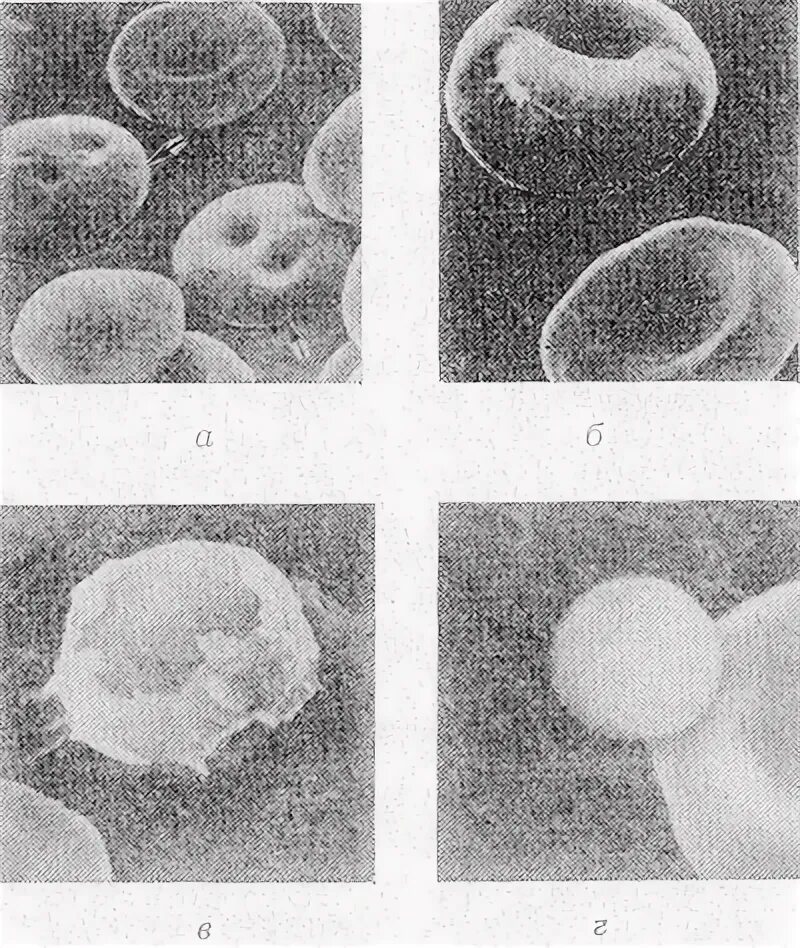 Безъядерный форменный элемент. Стоматоциты. Образцы эритроцитов на электронном микроскопе. Мазок крови человека рисунок с обозначениями форменных элементов.