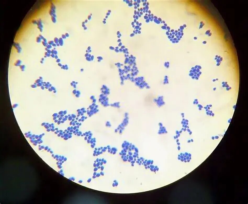 Антитела к candida albicans. Антитела к candida albicans