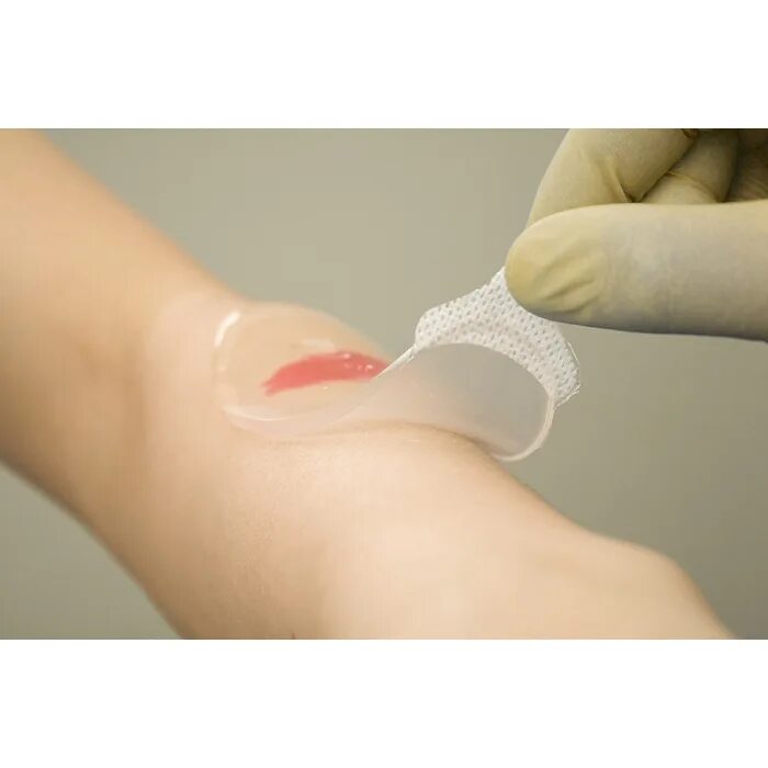 Повязка гидрогелевая раневая стерильная аквабинт овал 5,5х11см. Пластырь для заклеивания швов после операции. Burnacare relieve burn gel. Аквабинт повязка гидрогелевая раневая. Повязка покрытие гелепран.