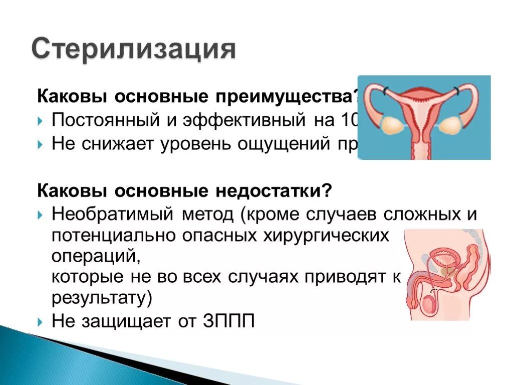 Хирургическая стерилизация метод контрацепции. Хирургические методы контрацепции. Мужская стерилизация. Хирургические методы контрацепции у женщин.