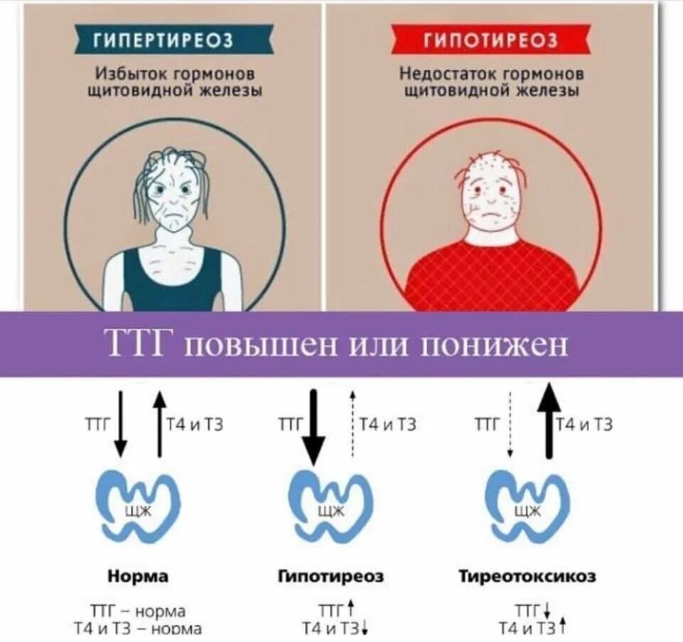 Нормы показателей гормонов щитовидной железы. Показатели гормонов щитовидки при гипотиреозе. ТТГ И т4 гипертиреоз и гипотиреоз. Гормонов щитовидной железы у мужчин ТТГ.