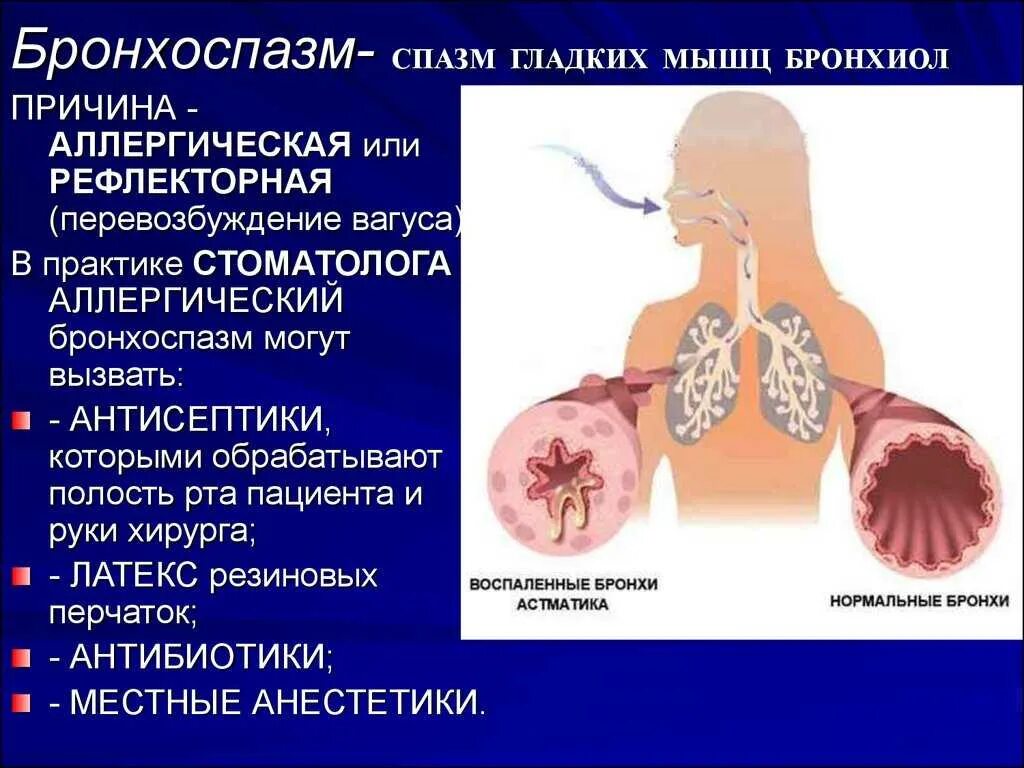 Основная причина бронхита. Спазм гладкой мускулатуры бронхов.