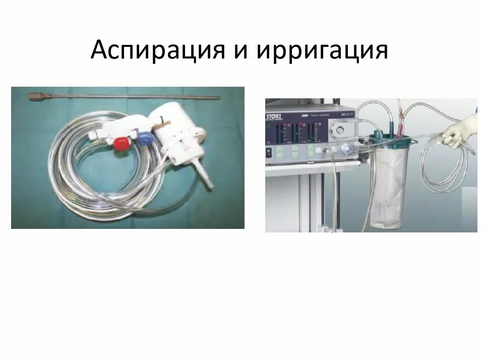 Аспирация в больнице. Аспирация в больнице