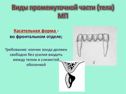 Промежуточная форма