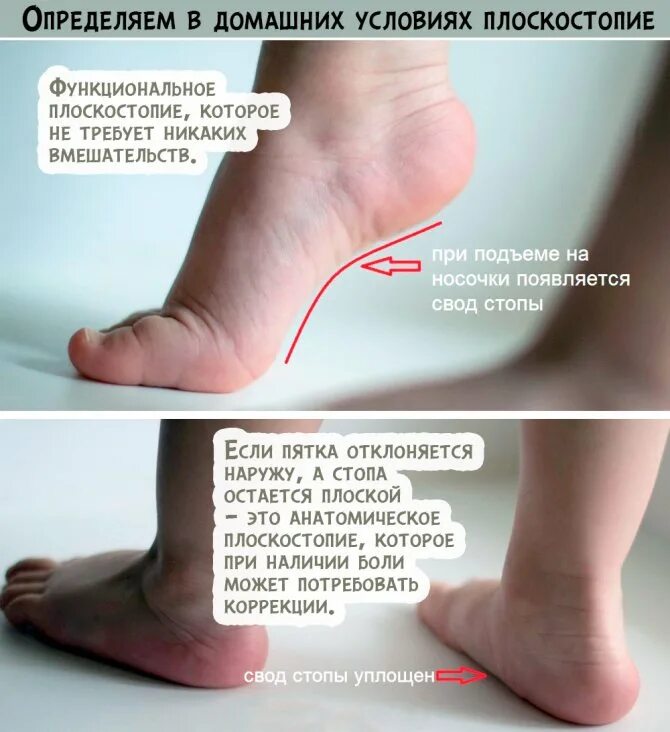 в каком возрасте плоскостопие. в каком возрасте плоскостопие. в каком возрасте плоскостопие. в каком возрасте плоскостопие. плоскостопие у детей 6 лет отпечаток стопы.