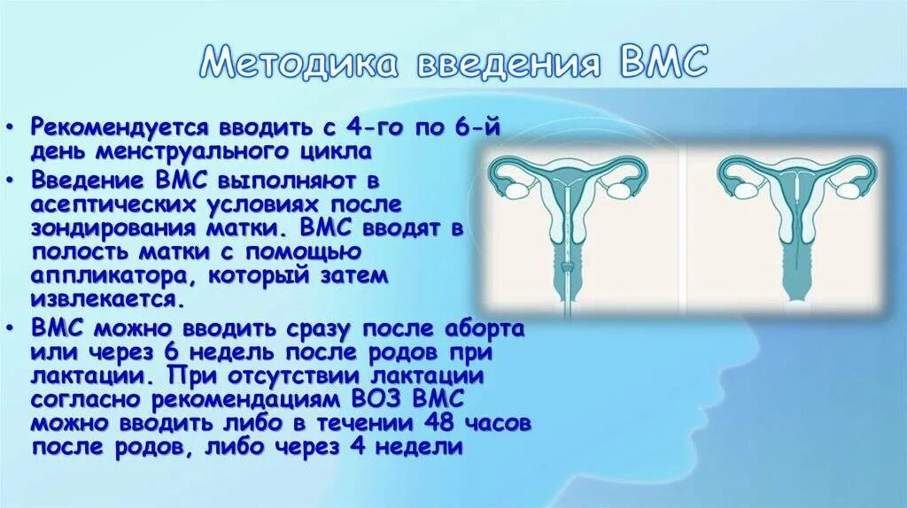 Введение вмс. ВМС спираль метод введения. Введение внутриматочной спирали алгоритм. Введение внутриматочной спирали (ВМС). Постановка ВМС алгоритм.