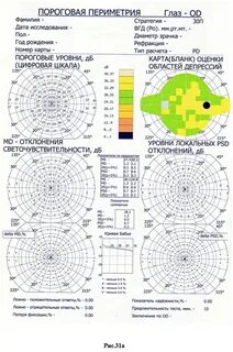 Компьютерная периметрия расшифровка
