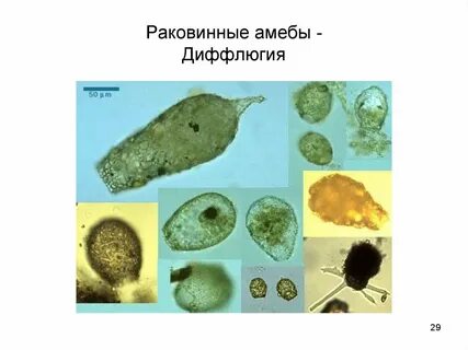Амеба обитает в пресных водоемах