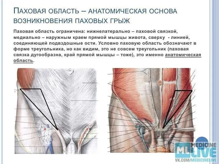 Иррадиация в паховую область. Строение паховой области. Мышцы паховой области. Паховая область анатомия. Анатомия паховой области у мужчин.