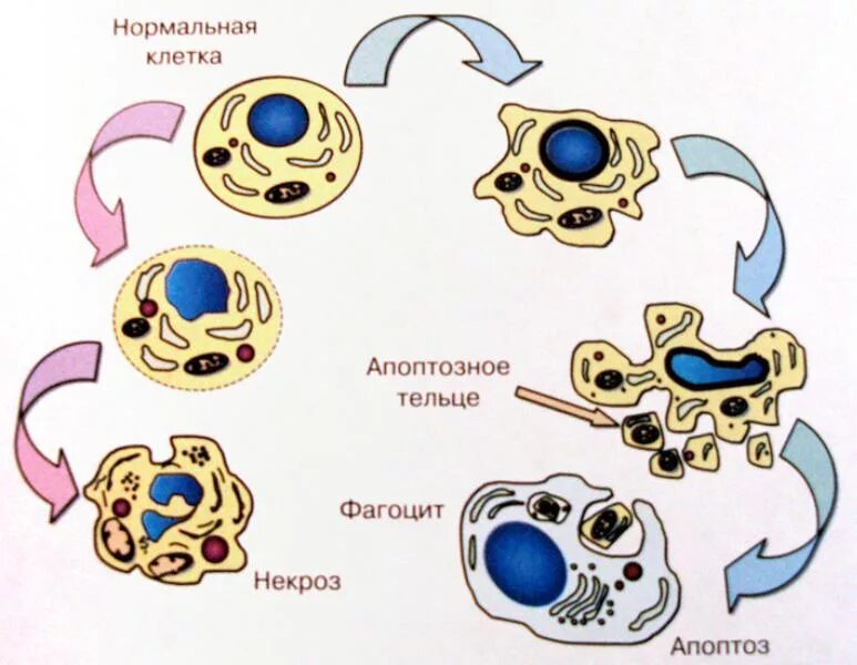 Гибель клетки апоптоз и некроз схема. Некроз и апоптоз клетки. Гибель клетки апоптоз и некроз. Схема гибели клеток при некрозе и апоптозе. Необратимые изменения клетки