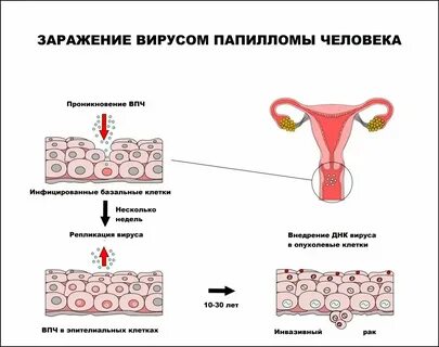 Впч от мужчины к женщине