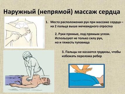 Как правильно делать массаж сердца