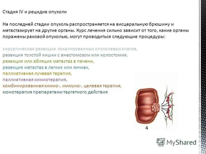 Вылечили последнюю стадию рака. Степени раковых заболеваний. Вылечили последнюю стадию рака. Стадии онкологии легкого. Карцинома легких 4 стадия.