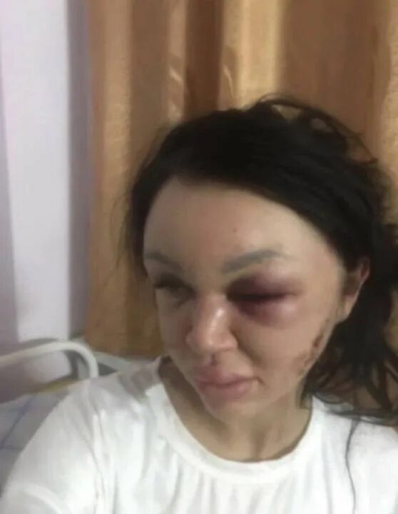 Ответы Mail.ru: упал со скейта, рана вроде не глубокая, как думаете, доживу до з