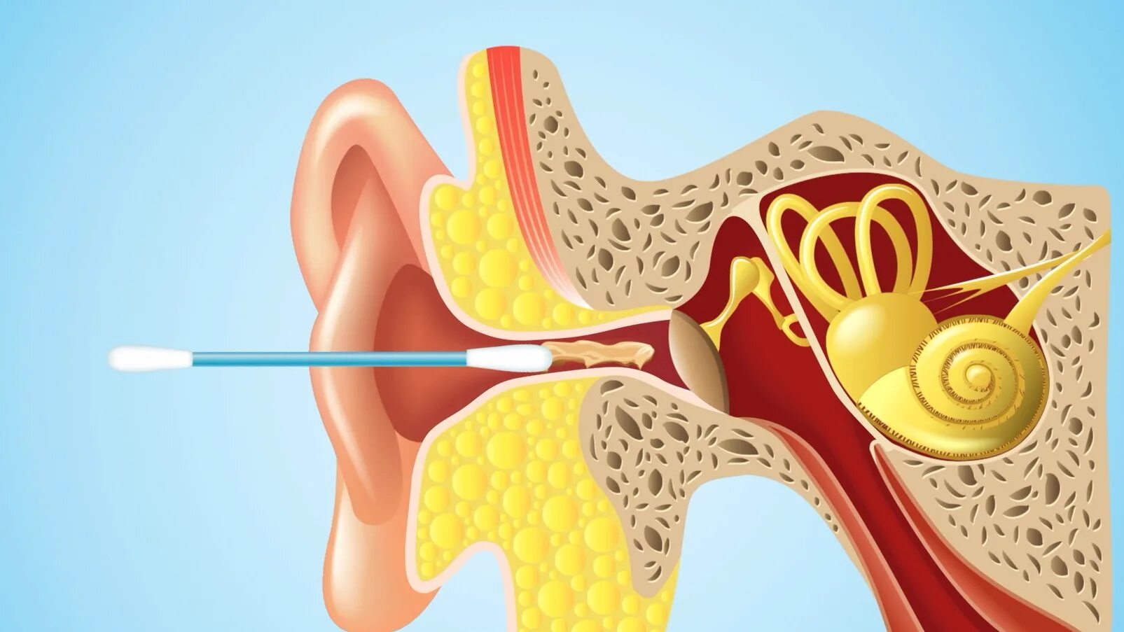 Серная пробка на барабанной перепонке. Анатомия уха серная пробка. Строение уха человека серная пробка. Строение уха ушная пробка. Серо чистить