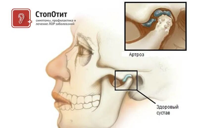Сводит челюсть. Сводит челюсть