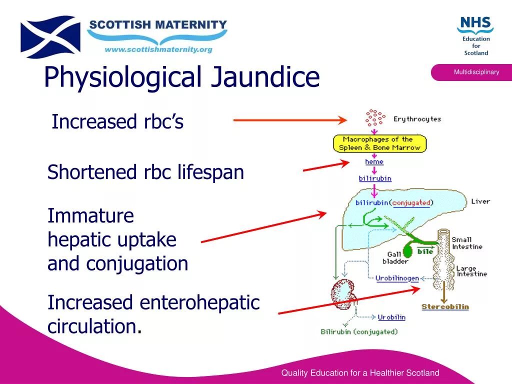 Physiological response. Physiological jaundice. cholestatic jaundice.
