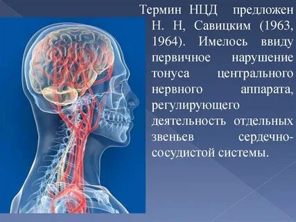 Всд голова
