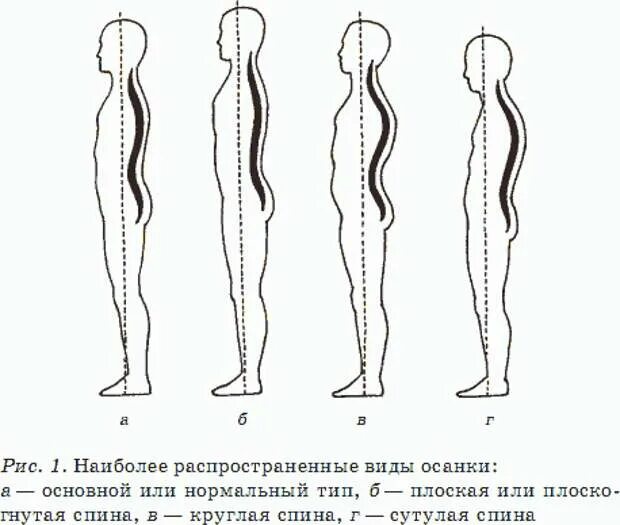 Как выглядит осанка