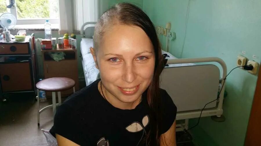 Волосы после химиотерапии. После химиотерапии выпадают волосы. Облысение после химиотерапии. Алопеция при химиотерапии.