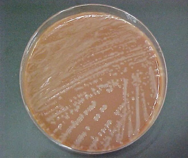 Гемофилус инфлюэнце. Гемофилус агар. Haemophilus influenzae микробиология. Гемофильная палочка микробиология.