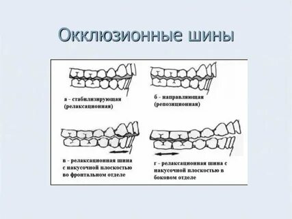 Схема капы