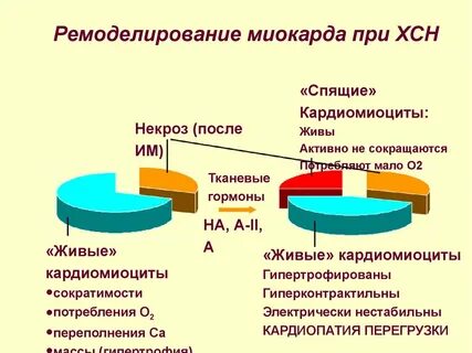 Концентрическое ремоделирование левого желудочка