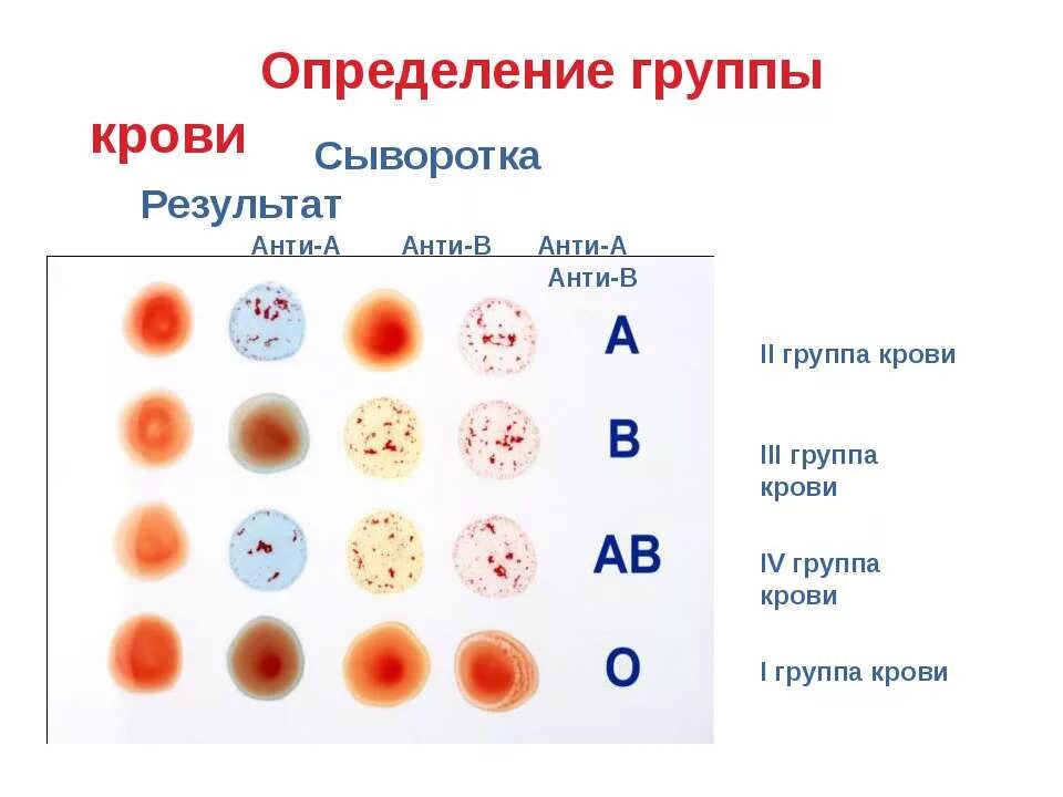 Определите резус фактора группы крови человека. Наборы реагентов для определения групп крови и резус-фактора. Определение группы крови по цоликлонам таблица. Цоликлоны для определения группы крови таблица. Результат определения группы крови