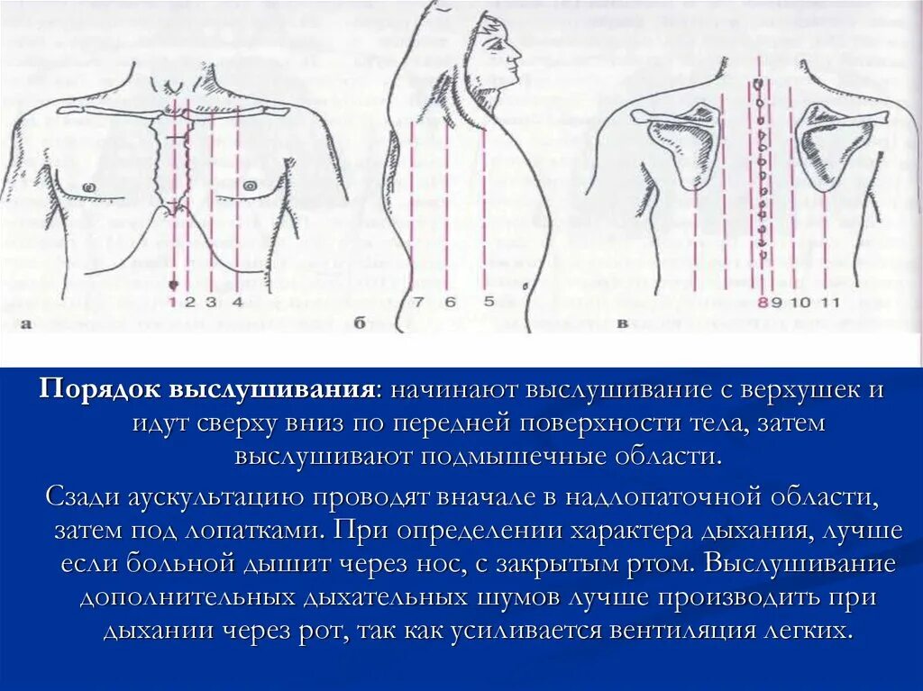 Алгоритм аускультации. Аускультация легких спереди. схема сравнительной аускультации легких. аускультация легких алгоритм точки. аускультация грудной клетки алгоритм.