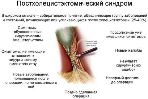 После операции какие симптомы