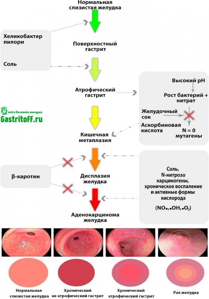 Хронический атрофический гастрит терапия. Схемы возникновения гастрита. Хронический гастрит симптомы. Признаки развития гастрита. Восстановление слизистой желудка и кишечника