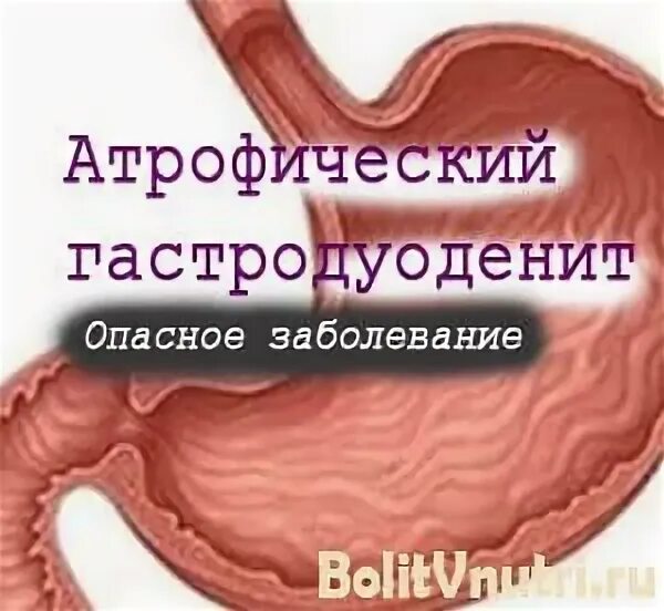 Повышенный гастродуоденит. Неатрофический гастродуоденит. Атрофический гастродуоденит. Хронический атрофический гастродуоденит. Очаговый атрофический гастродуоденит.