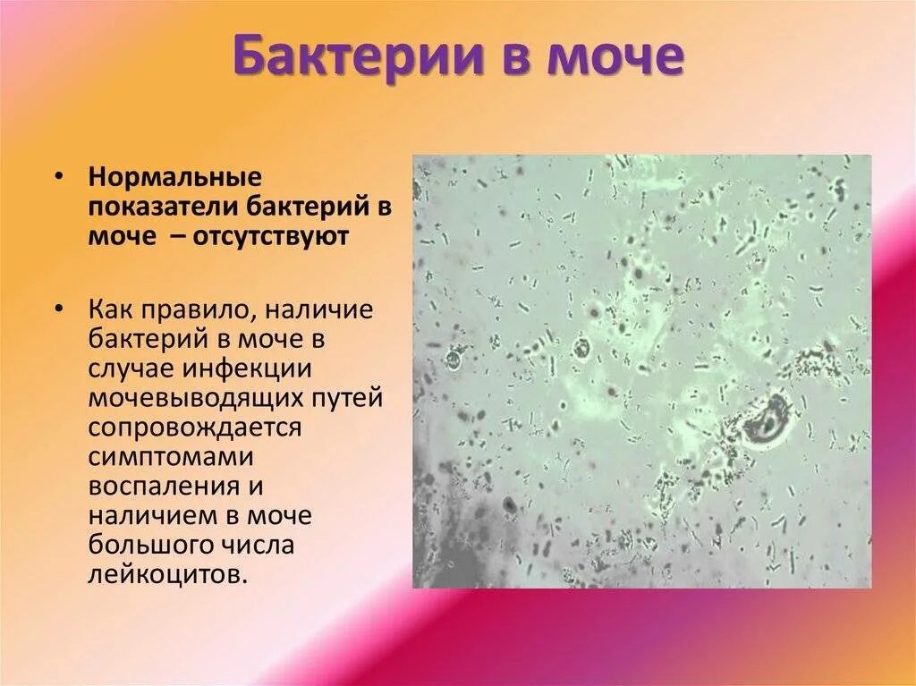 Бактериурия характерна. Бактерии в моче. Микроорганизмы в моче. Бактерии в моче микроскопия. Бактерии в моче у женщин причины.