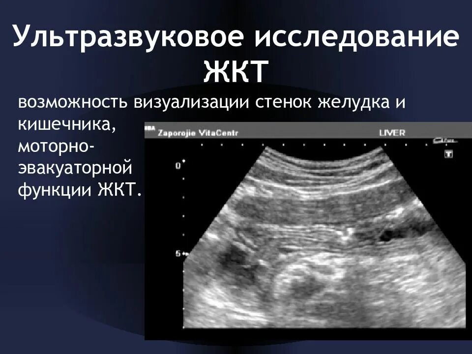 УЗИ Толстого кишечника при патологии. Ультразвуковое исследование желудка. Узи кишечника как подготовиться