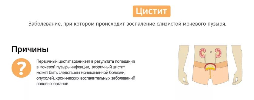 Цистит у мужчин симптомы и лечение. Цистит у мужчин симптомы. Воспаление мочевого пузыря симптомы. Признаки цистита у мужчин.